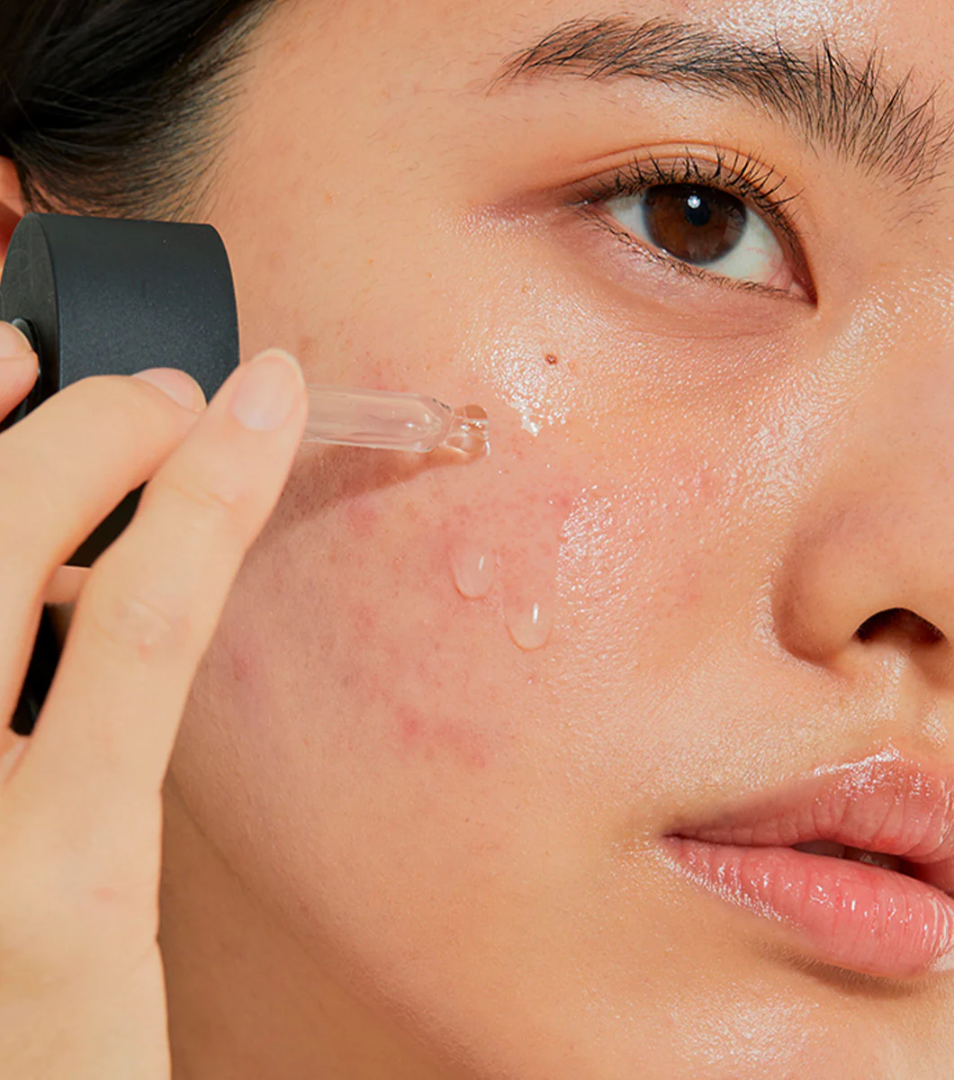 COSRX THE NIACINAMIDE 15 SERUM 20mL | Serum con un 15% de niacinamida - Image 3